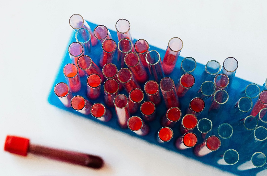 Dwie bezpłatne akcje profilaktyczne - Badanie krwi i Różowy Październik